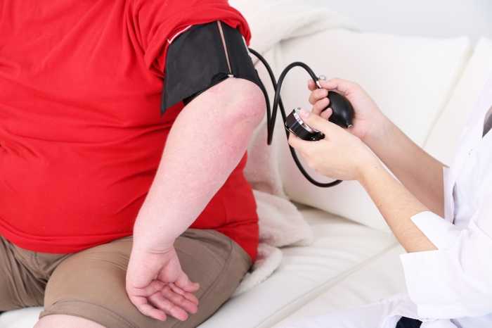  What is Obesity Risk and what is the perfect Treatment of Obesity?